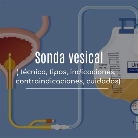 sonda vesical mujer real|Colocación de Sonda vesical en mujer